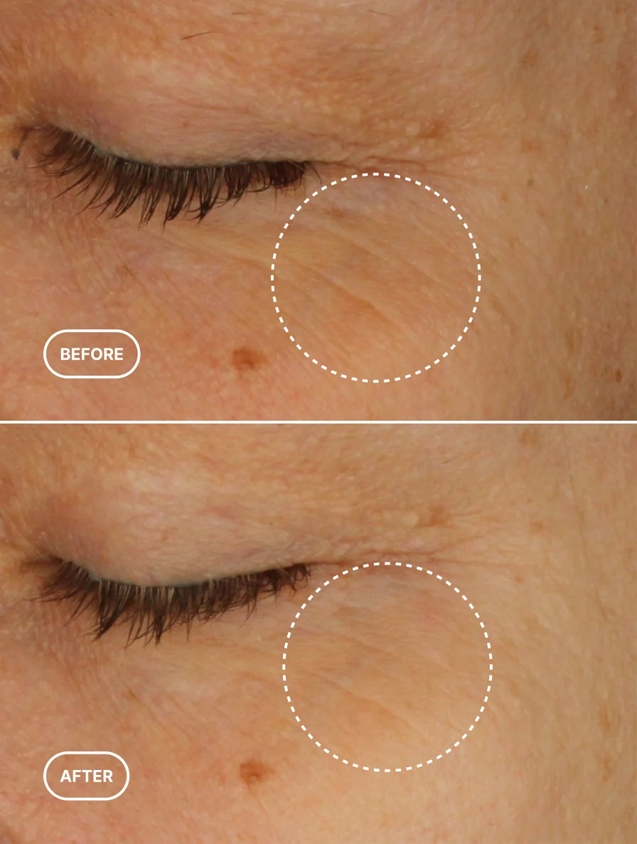 Retinol Alternative Eye Cream